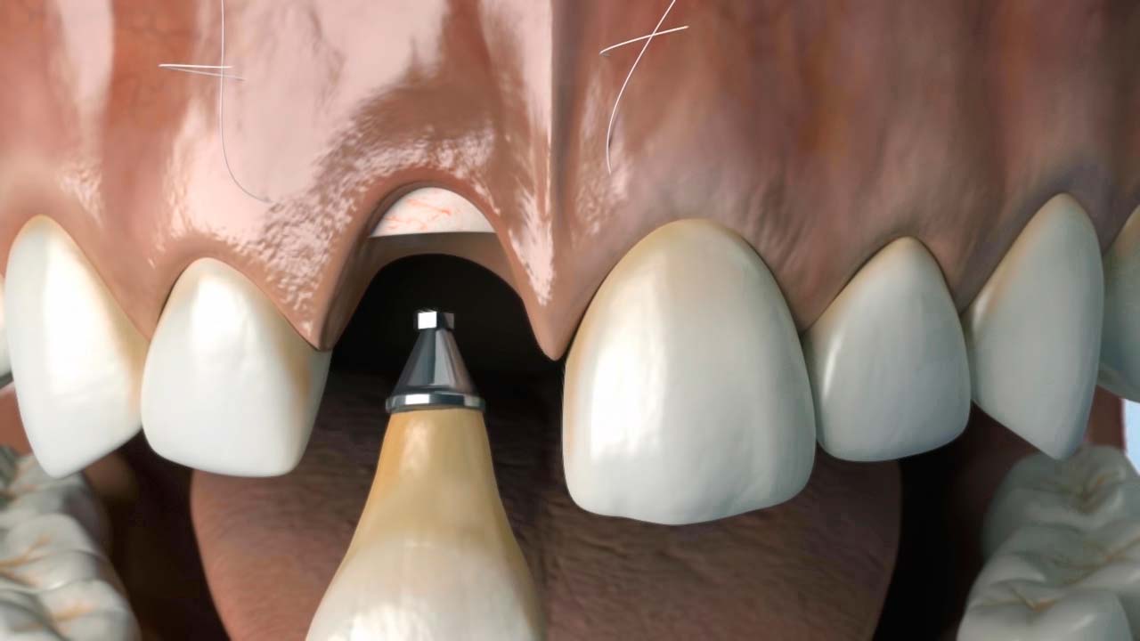 odontología 3D, Virtual Art animación 3d vídeo 3D